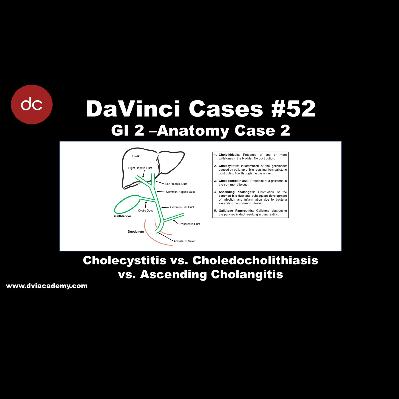 Cholecystitis vs Choledocholithiasis vs Ascending Cholangitis [#DaVinciCases GI 2 - Anatomy Case 2]