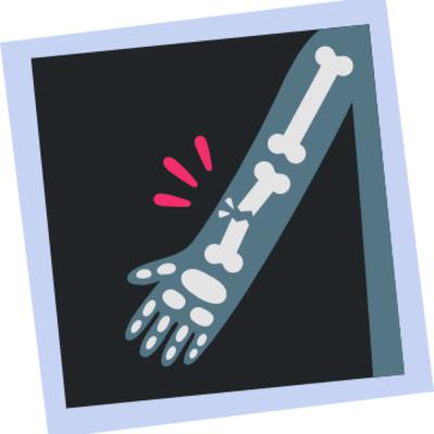 Fractures: Assessment, Treatment, and Management