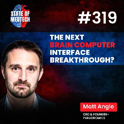 BCI: Paradromics Founder Matt Angle on BCI and the Race to High-Speed Brain Interfaces