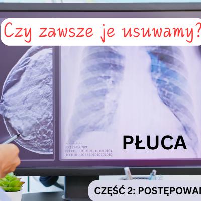 Odcinek 148. Czy zawsze usuwamy przerzuty raka piersi do płuc?