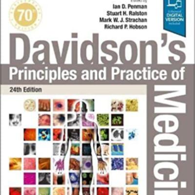 مسمومیت با استامینوفن