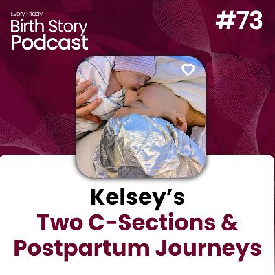 Birth Story 73: Kelsey’s Two C-Sections & Postpartum Journeys