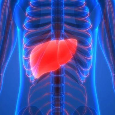 cirrosis hepatica