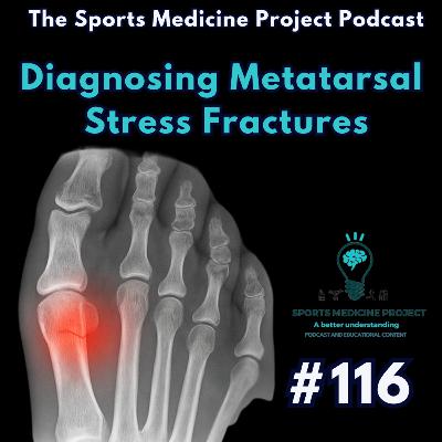 How To Diagnose Metatarsal Stress Fractures #116