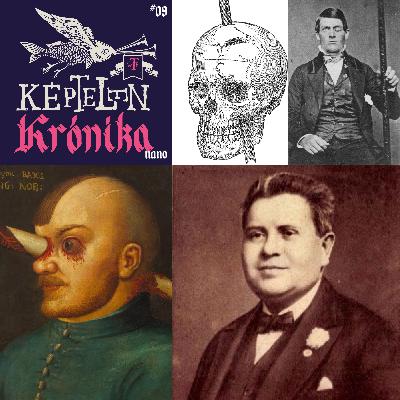 KK Nano #09 – Bumm a fejbe