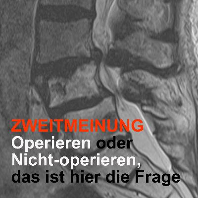 ZWEITMEINUNG - Operieren oder  Nicht-operieren,  das ist hier die Frage