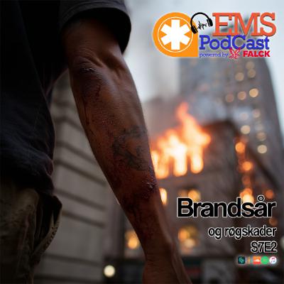 S7E2 - Brandsår og røgskader