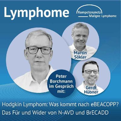 Hodgkin Lymphom: Was kommt nach eBEACOPP? Das Für und Wider von N-AVD und BrECADD Hodgkin Lymphom: Was kommt nach eBEACOPP? Das Für und Wider von N-AVD und BrECADD