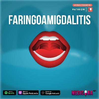 14. Faringoamigdalitis
