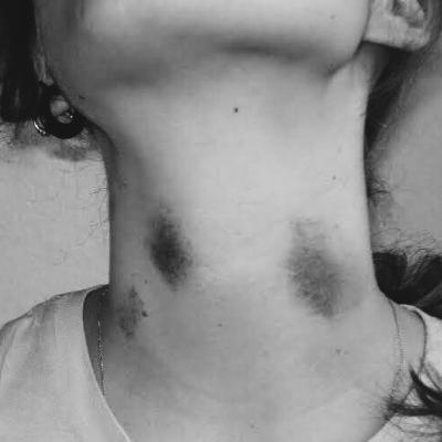 Eps 4 - Cupang Red Army