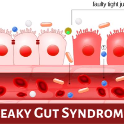 your leaky gut & immune system… your leaky gut & immune system…