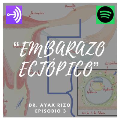 Embarazo ectópico, la importancia del diagnóstico oportuno.