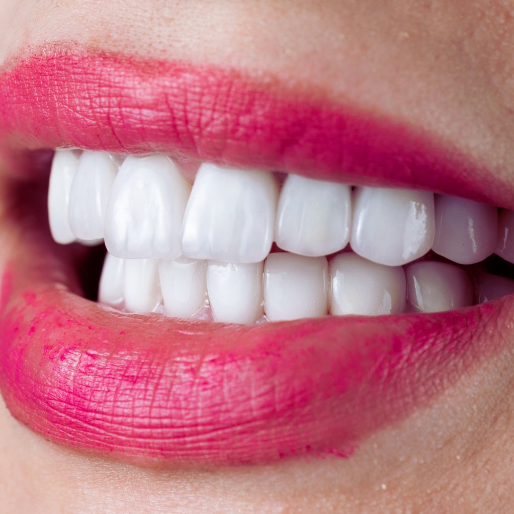 Maintaining and Caring for Your Porcelain Veneers: Dos and Don’ts