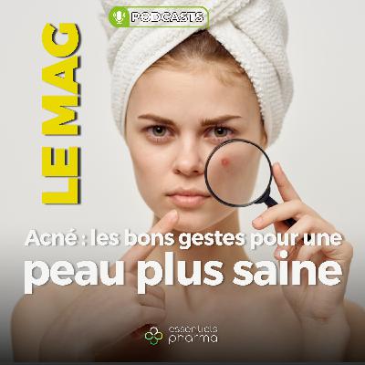 Acné : les bons gestes pour une peau plus saine