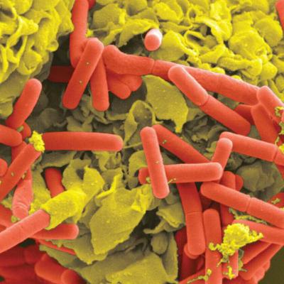 Innate Immunity (immunology part 4)