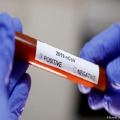 COVID-19 infection rate expected to soar even further COVID-19 infection rate expected to soar even further