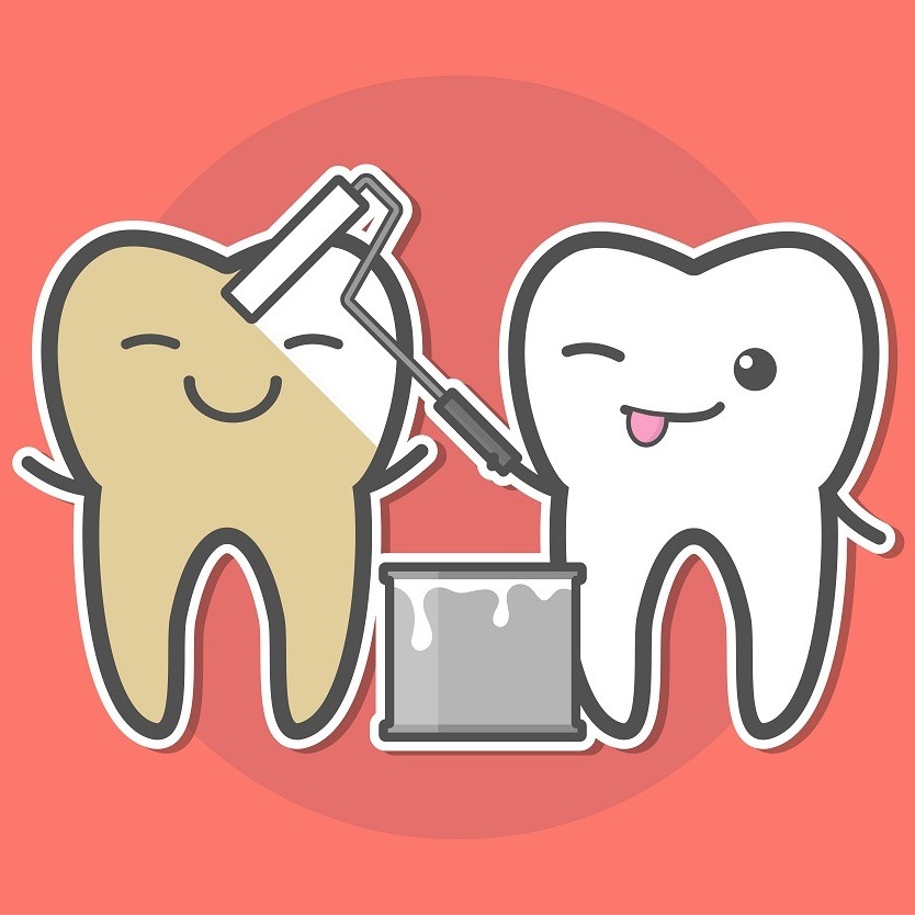 The OPTISMILE Podcast 122 - Whitening a Single Dark Tooth