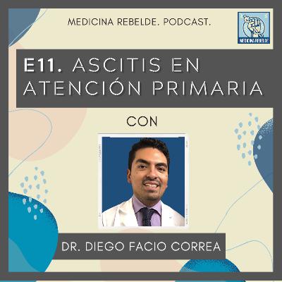 E11. Ascitis en la atención primaria E11. Ascitis en la atención primaria