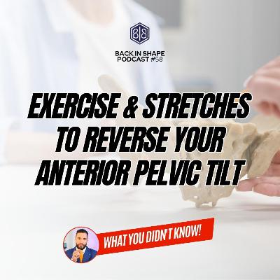 Anterior Pelvic Tilt & Back Pain: Fix It With Exercises & Stretches