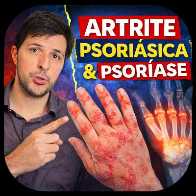 Junta (#12): Psoríase e Artrite Psoriásica Junta (#12): Psoríase e Artrite Psoriásica