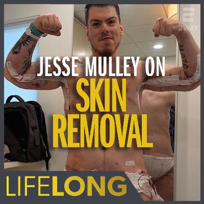Jesse Mulley on Skin Removal Surgery & Losing 290 lbs | LifeLONG Ethan Suplee Jesse Mulley on Skin Removal Surgery & Losing 290 lbs | LifeLONG Ethan Suplee