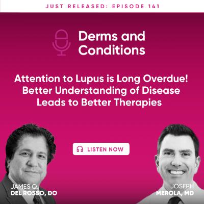 Attention to Lupus is Long Overdue! Better Understanding of Disease Leads to Better Therapies Attention to Lupus is Long Overdue! Better Understanding of Disease Leads to Better Therapies