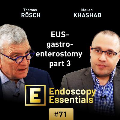 EUS-guided gastroenterostomy part 3 trouble shooting