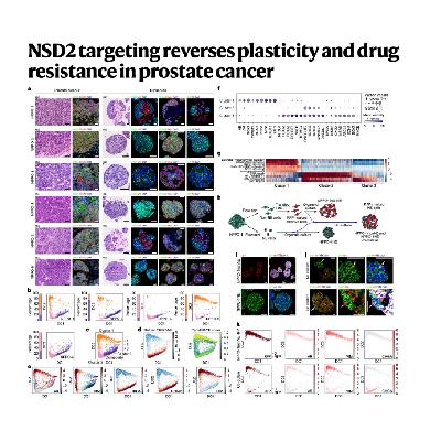 306-NSD2 targeting reverses plasticity in prostate cancer 306-NSD2 targeting reverses plasticity in prostate cancer