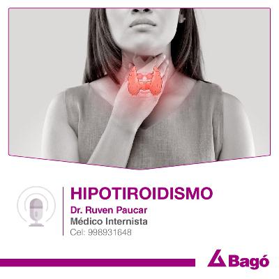 HIPOTIROIDISMO
