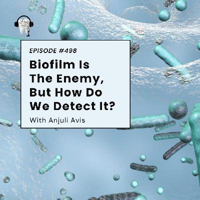498 Biofilm Is The Enemy, But How Do We Detect It? With Anjuli Avis