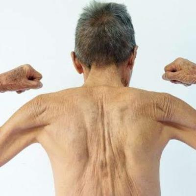 Sarcopenia e benefícios do whey protein.