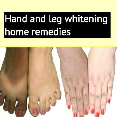 गर्मियों में कच्चे दूध में ये 2 चीजें मिलाकर लगालो, हाथ पैर दूध जैसे गोरे Hand Whitening Foot Light