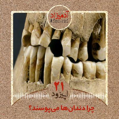 اپیزود 21: چرا دندان‌ها می‌پوسند؟ -گفتگویی با عرفان خسروی