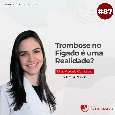 #87 - Trombose no Fígado é uma Realidade?