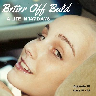 Better Off Bald: Episode 18 — Days 51 – 52