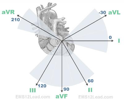 EKG Leads EKG Leads