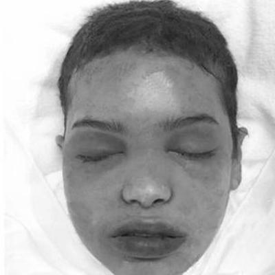 The Teteringen Girl – Unidentified, Murdered, and Forgotten? | Dutch Cold Case 1990