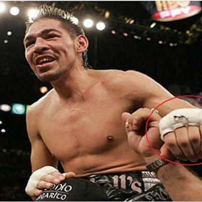 Antonio margarito boxeador acusado de hacer tramposo #sport Antonio margarito boxeador acusado de hacer tramposo #sport