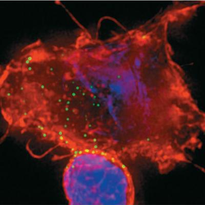 Immunodeficiency Diseases( immunology part 18) Immunodeficiency Diseases( immunology part 18)