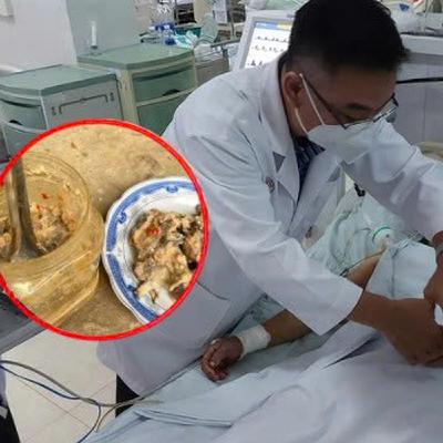 Vụ ngộ độc khi ăn cá ủ chua: Bác sĩ chỉ cách nhận biết thực phẩm chứa độc tố botulinum