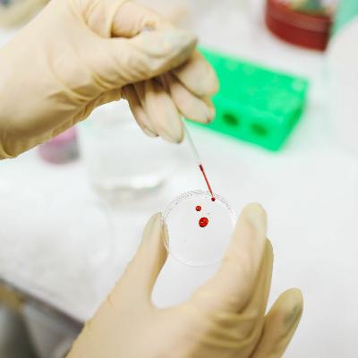 TechNOW: A new test to tackle ovarian cancer