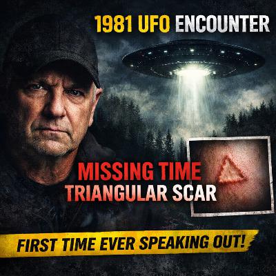 First-Ever Interview: Michigan Experiencer’s 1981 UFO Encounter & Unexplained Scar | Doug Wilgocki