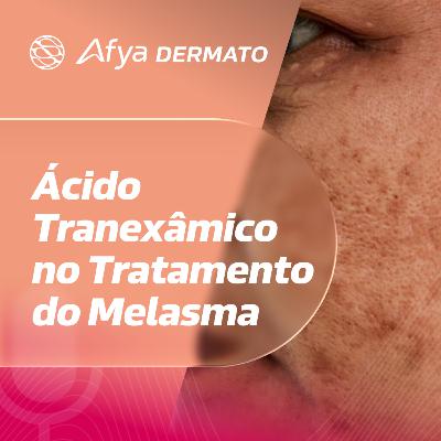 Ácido Tranexâmico no tratamento do melasma