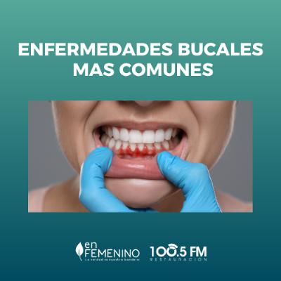 Enfermedades bucales más comunes Enfermedades bucales más comunes