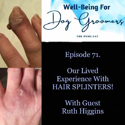 Episode 71 Ruth Higgins ... Our Lived Experiences with HAIR SPLINTERS!