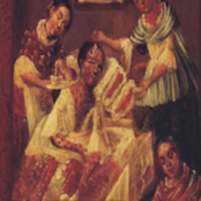 4. VIRUELA, historia, clínica, inoculación.