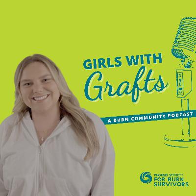 Healing Forward: From Childhood Burn Survivor to Future Occupational Therapist