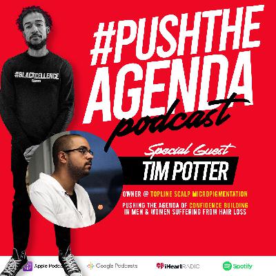Tim Potter - Scalp Micropigmentation, Confidence, & Advice for starting fast