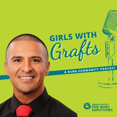 A Painful Blessing: Francisco Padilla’s Journey from Burn Survivor to Physical Therapist A Painful Blessing: Francisco Padilla’s Journey from Burn Survivor to Physical Therapist