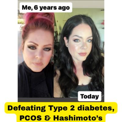 Defeating Type 2 diabetes, PCOS & Hashimoto’s symptoms S2E23 podcast